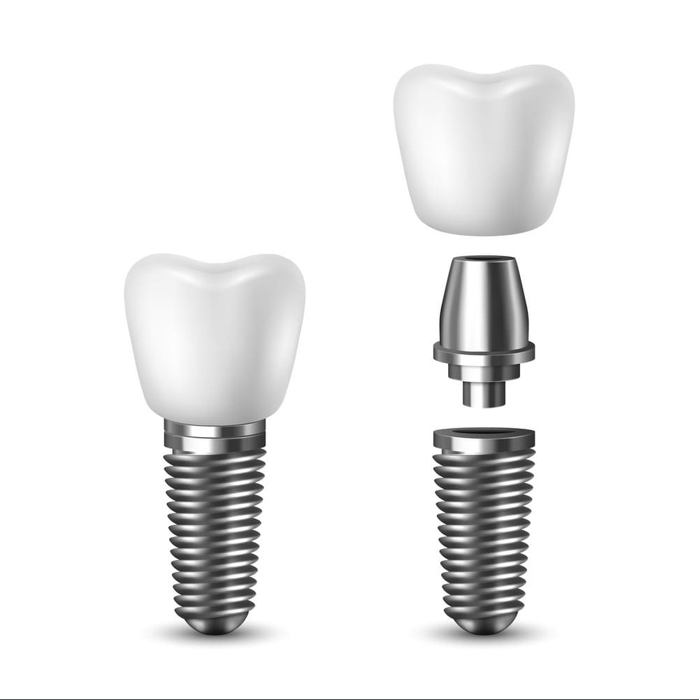 Conventional implants