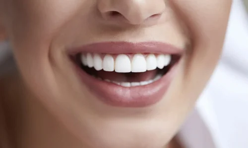 Cosmetic dental clinic- smile correction